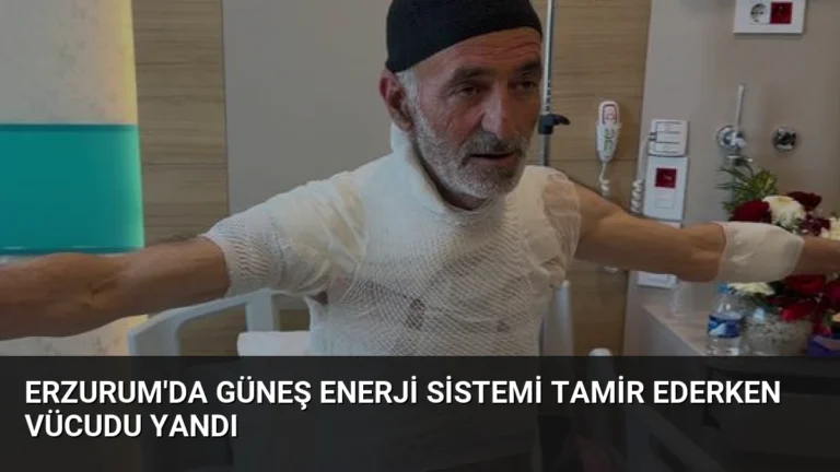 Erzurum’da Güneş Enerji Sistemi Tamir Ederken Vücudu Yandı