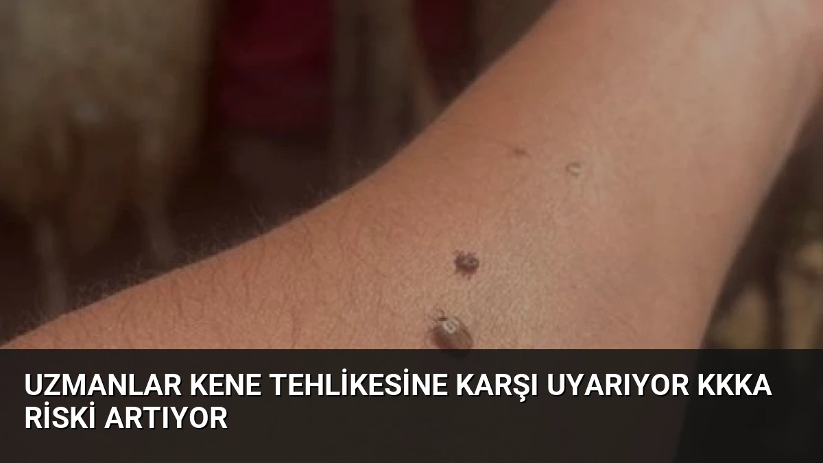 Uzmanlar Kene Tehlikesine Karşı Uyarıyor KKKA Riski Artıyor