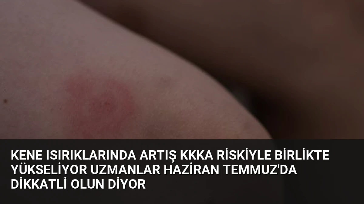 Kene Isırıklarında Artış KKKA Riskiyle Birlikte Yükseliyor Uzmanlar Haziran Temmuz’da Dikkatli Olun Diyor